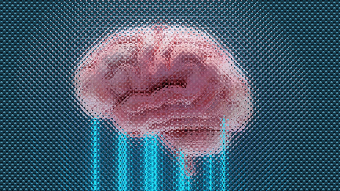 Neural network
